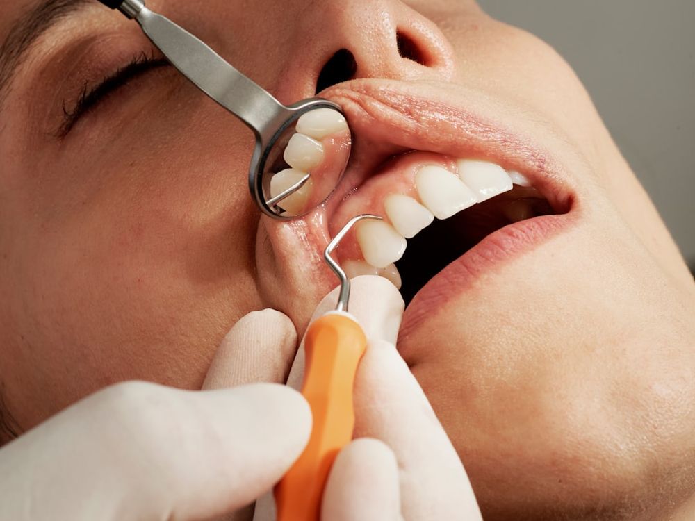 cosmetic dental treatment